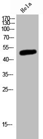 MKNK2 antibody