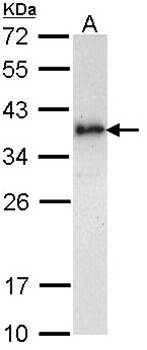 ML-IAP antibody