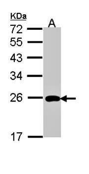 ML-IAP antibody