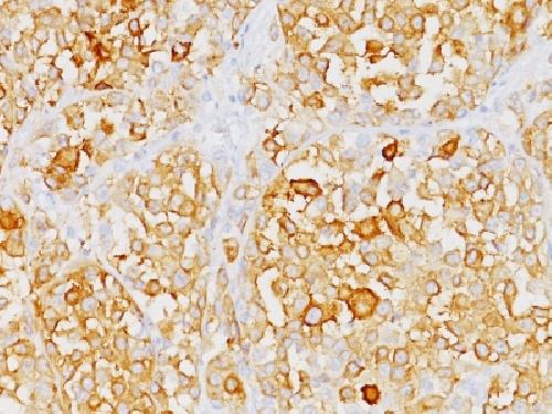 MLANA Antibody