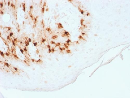 Recombinant MART-1 / Melan-A / MLANA (Melanoma Marker) Antibody