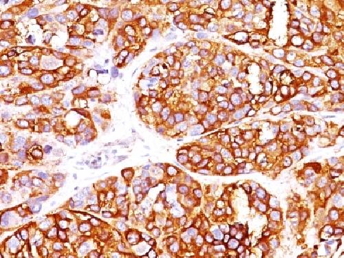 Recombinant MART-1 / Melan-A / MLANA (Melanoma Marker) Antibody