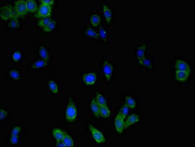 MLC1 Antibody