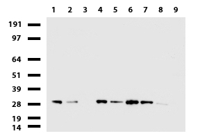 MLC1SA (MYL6B) antibody