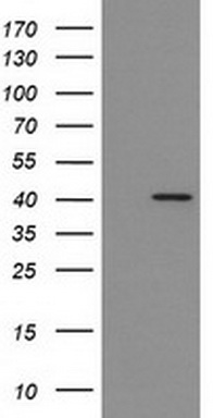 MLC1SA (MYL6B) antibody