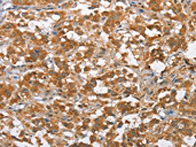 MLH1 Antibody