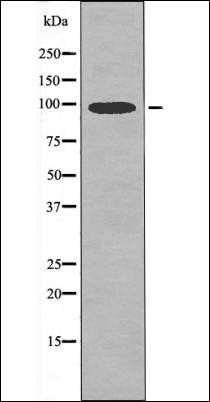 MLK3 (Phospho-Thr277+Ser281) antibody