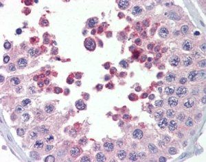 Goat anti-KMT2B/MLL4 Antibody