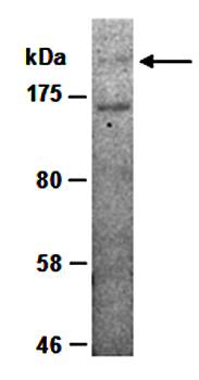 MLL5 antibody