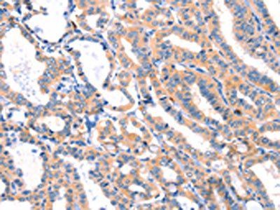 MLLT4 antibody