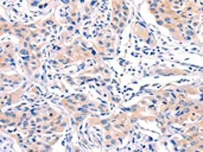 MLLT4 Antibody