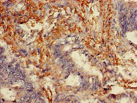 MLPH Antibody