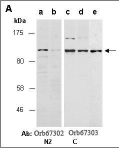 MLXIPL antibody pair