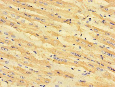 MLYCD Antibody