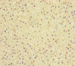 MMACHC Antibody