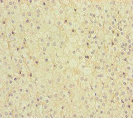 MMACHC Antibody