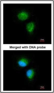 MMACHC antibody