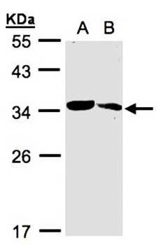 MMACHC antibody