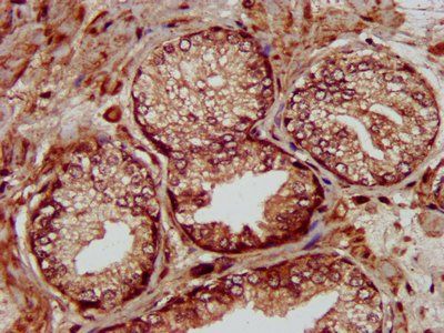 MMADHC Antibody