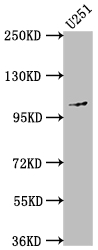 MME antibody