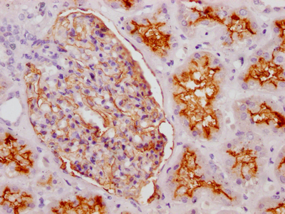 MME Recombinant Monoclonal Antibody