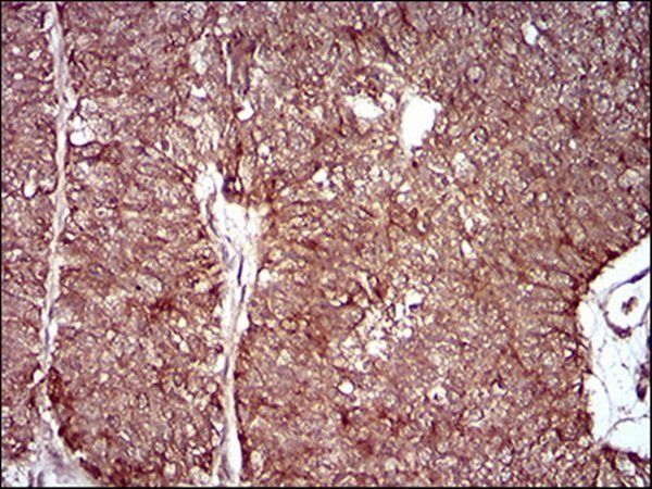 MMEL1 Antibody