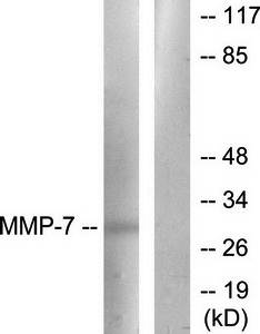 MMP-7 antibody
