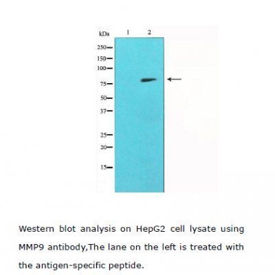 MMP-9 antibody