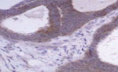 Mouse anti Human Matrix Metalloproteinase 1 (MMP1)
