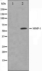 MMP1 Antibody