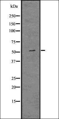 MMP12 antibody