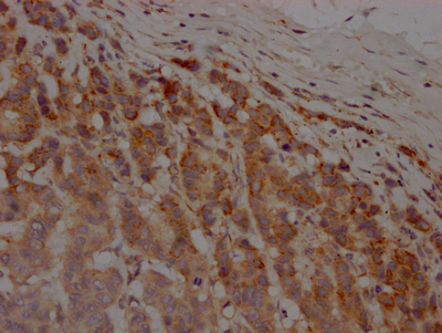 MMP12 Recombinant Monoclonal Antibody