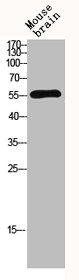 MMP13 Antibody