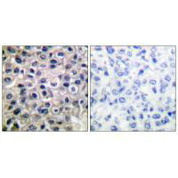 MMP14 antibody