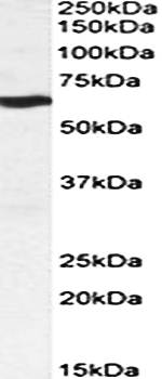 Goat anti-MMP14 Antibody