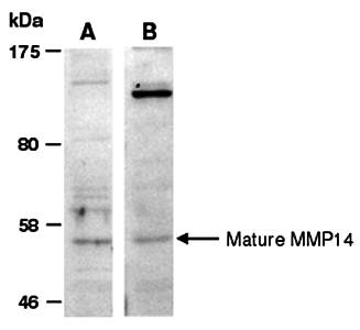 MMP14 (vPairTM) Antibodies