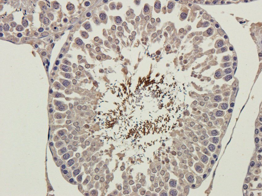 MMP15 antibody