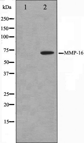 MMP16 antibody