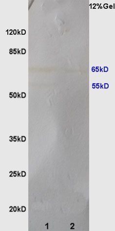 MMP16 Rabbit Polyclonal Antibody