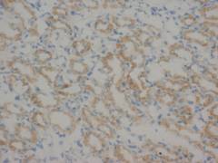 Anti-Matrix metalloproteinase-16 MMP16 Antibody