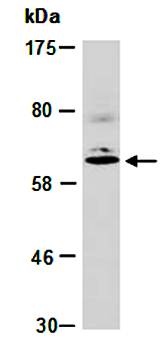 MMP16 antibody