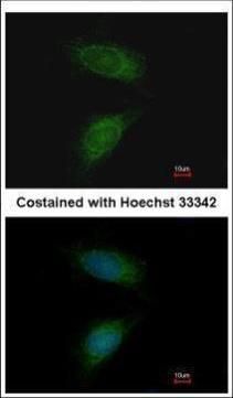 matrix metallopeptidase 2 Antibody