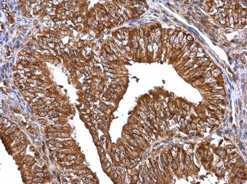 MMP2 Rabbit Polyclonal Antibody