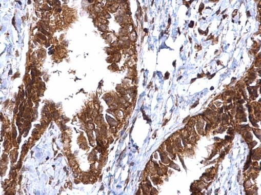 MMP2 Rabbit Polyclonal Antibody