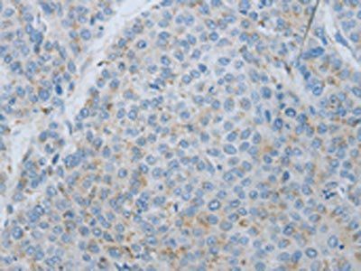 MMP25 antibody