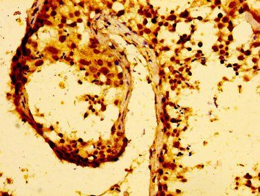 MMP28 antibody