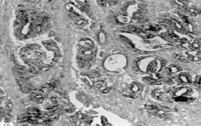 Mouse anti Human Matrix Metalloproteinase 3 (MMP3)