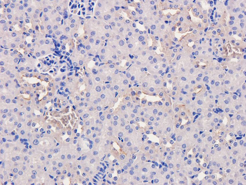 MMP3 Rabbit Polyclonal Antibody