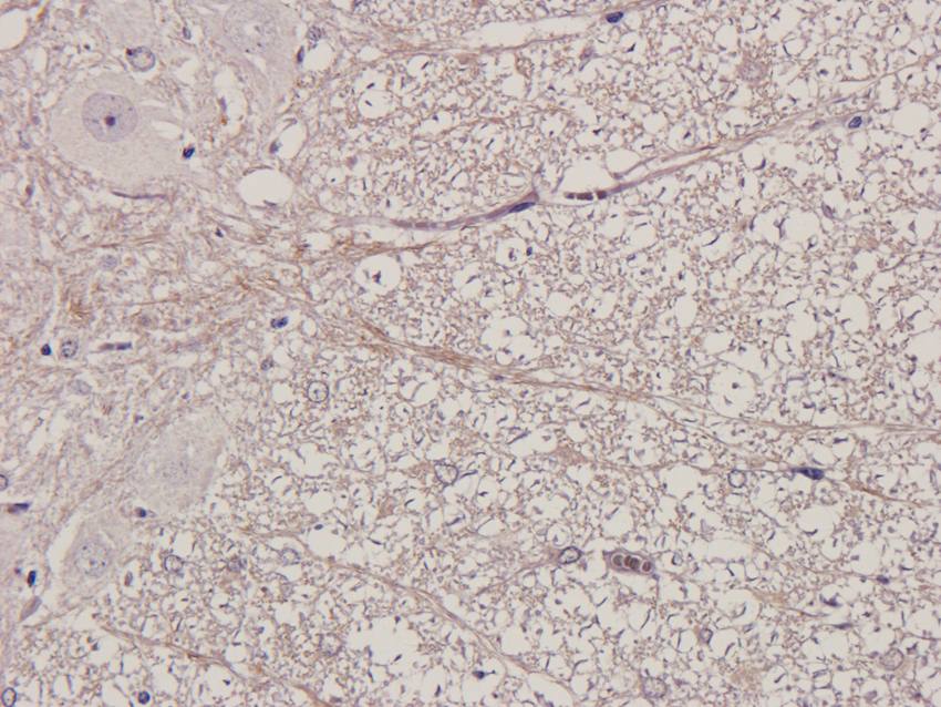 MMP3 Rabbit Polyclonal Antibody