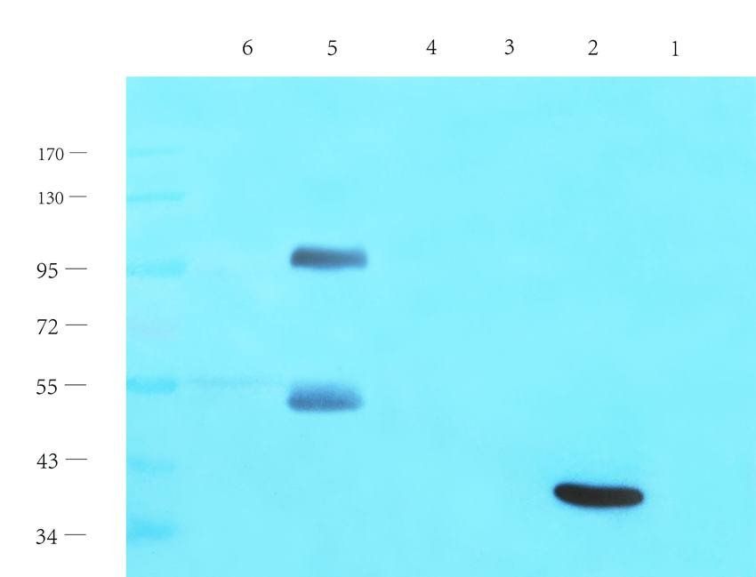 MMP3 antibody